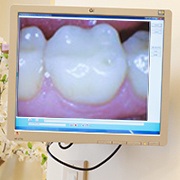 Intraoral images on chairside computer