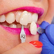 An up-close look at a dentist using a shade guide to determine the color of a patient’s porcelain veneers