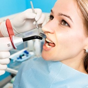 Dentist curing composite resin in Cleveland