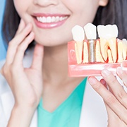 A closeup of a dental implant model held by a dentist