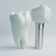 dental implant and crown next to actual tooth 