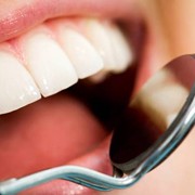 Tooth-Colored Fillings: Cavity Filling with Aesthetic Appeal