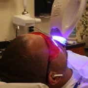 Closeup of dental patient before ZOOM! teeth whitening procedure
