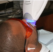 Patient treated with ZOOM! teeth whitening activation light